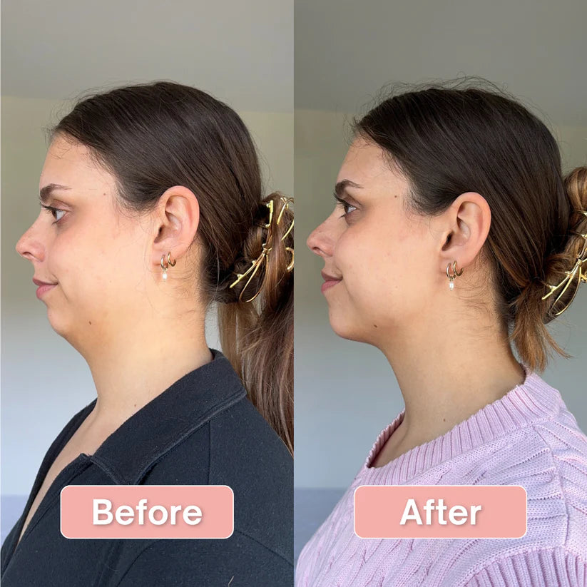 ByHer V-Line Lift Bands