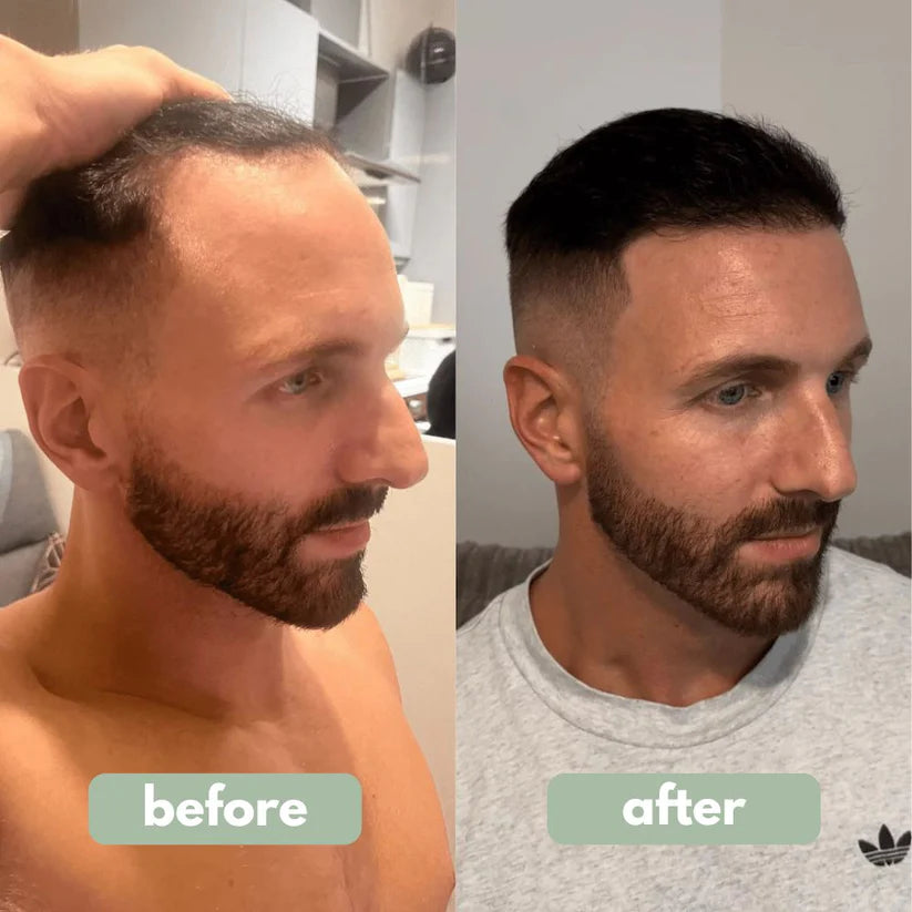 Reverse - Hair Growth Serum